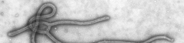 新たな発見が人類を救う？エボラが効かない遺伝子を発見！の画像