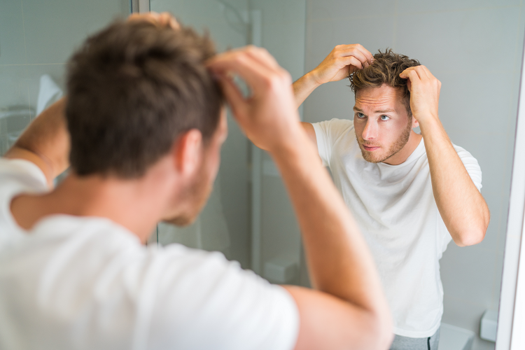 ストレスが原因の一つとも言われる円形脱毛症、意外な薬の治療効果が明らかになりました（写真：Shutterstock.com)