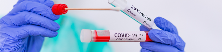 新型コロナウイルスのPCR検査・抗体検査・抗原検査、有効性と限界は？【医師によるコラム】の画像