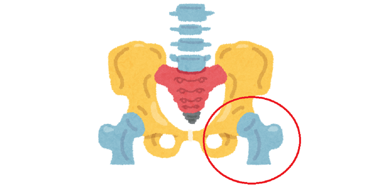 図１. 大腿骨近位部